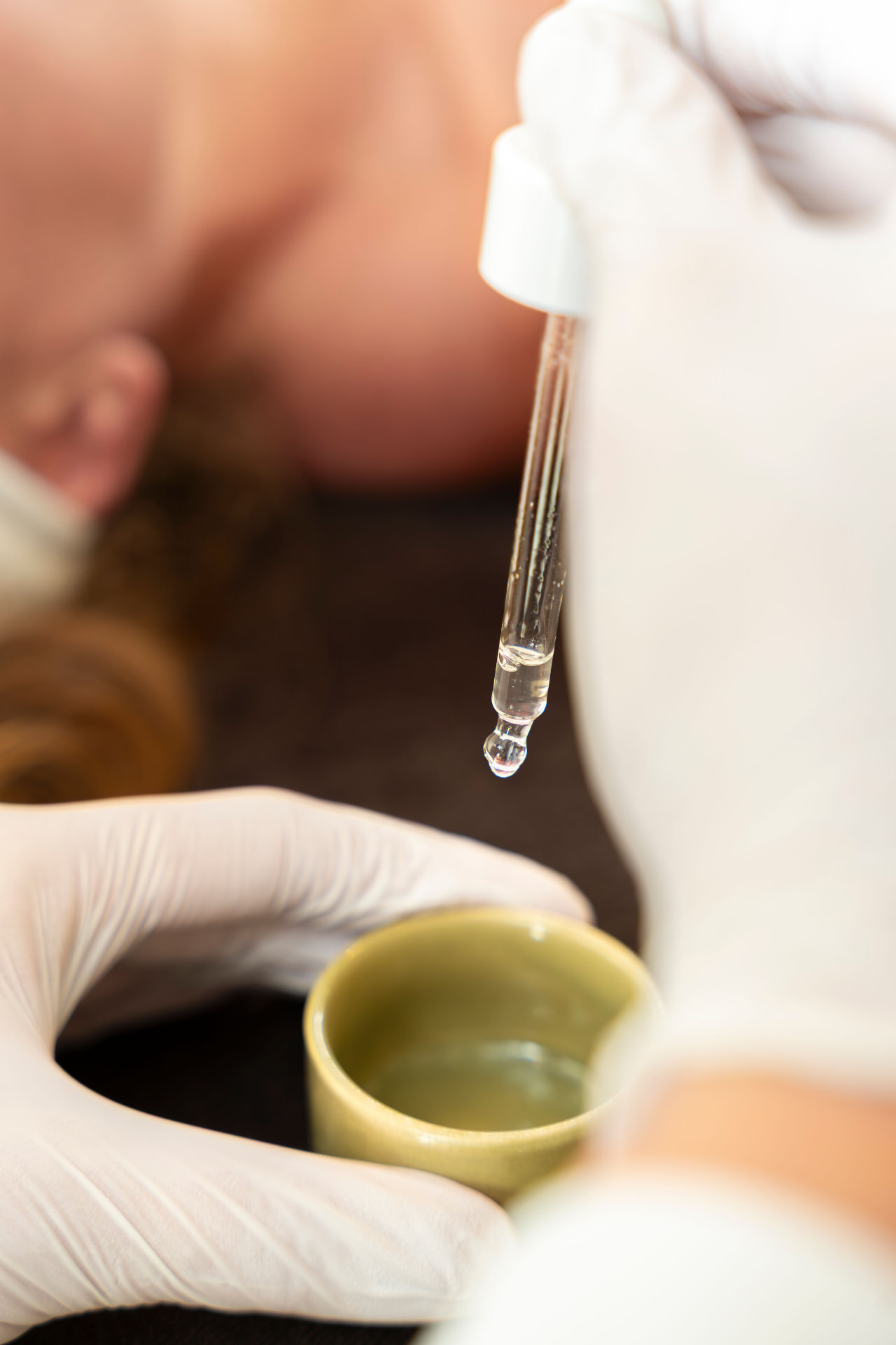 Medische peeling tijdens een huidbehandeling